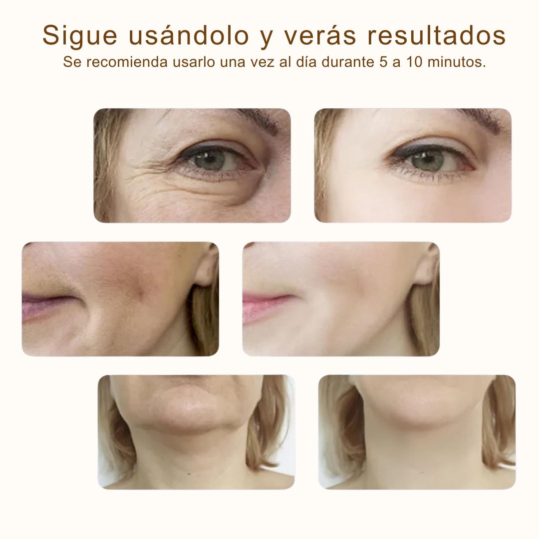 GlowLift Pro™ - Rejuvenecedor Facial - ¡Elimina Arrugas y Flacidez en 21 Días!